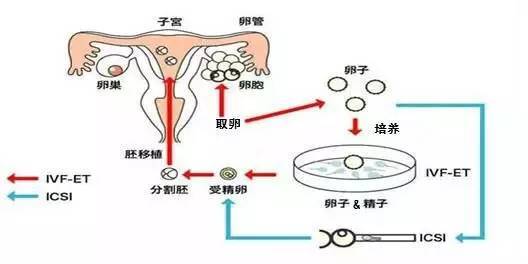 金华的第三代试管婴儿（PGT）过程与其他地区大致相同，但具体细节可能因医院而异。以下是一个大致的流程，请注意，这并非医疗建议，具体流程和细节需咨询金华当地正规医院的生殖医学专家。